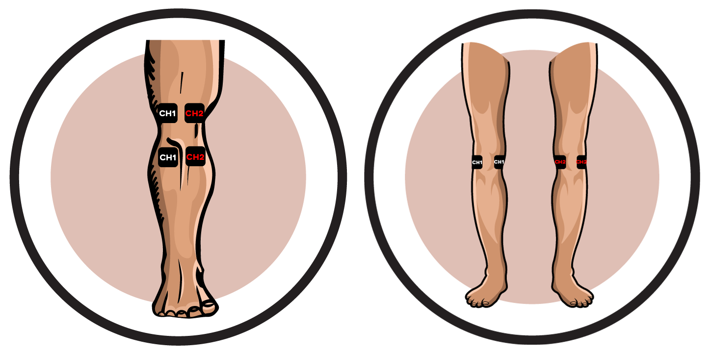 Knee Electrode Pad Placement