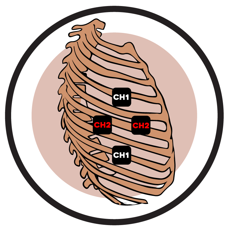 Rib Cage Electrode Pad Placement