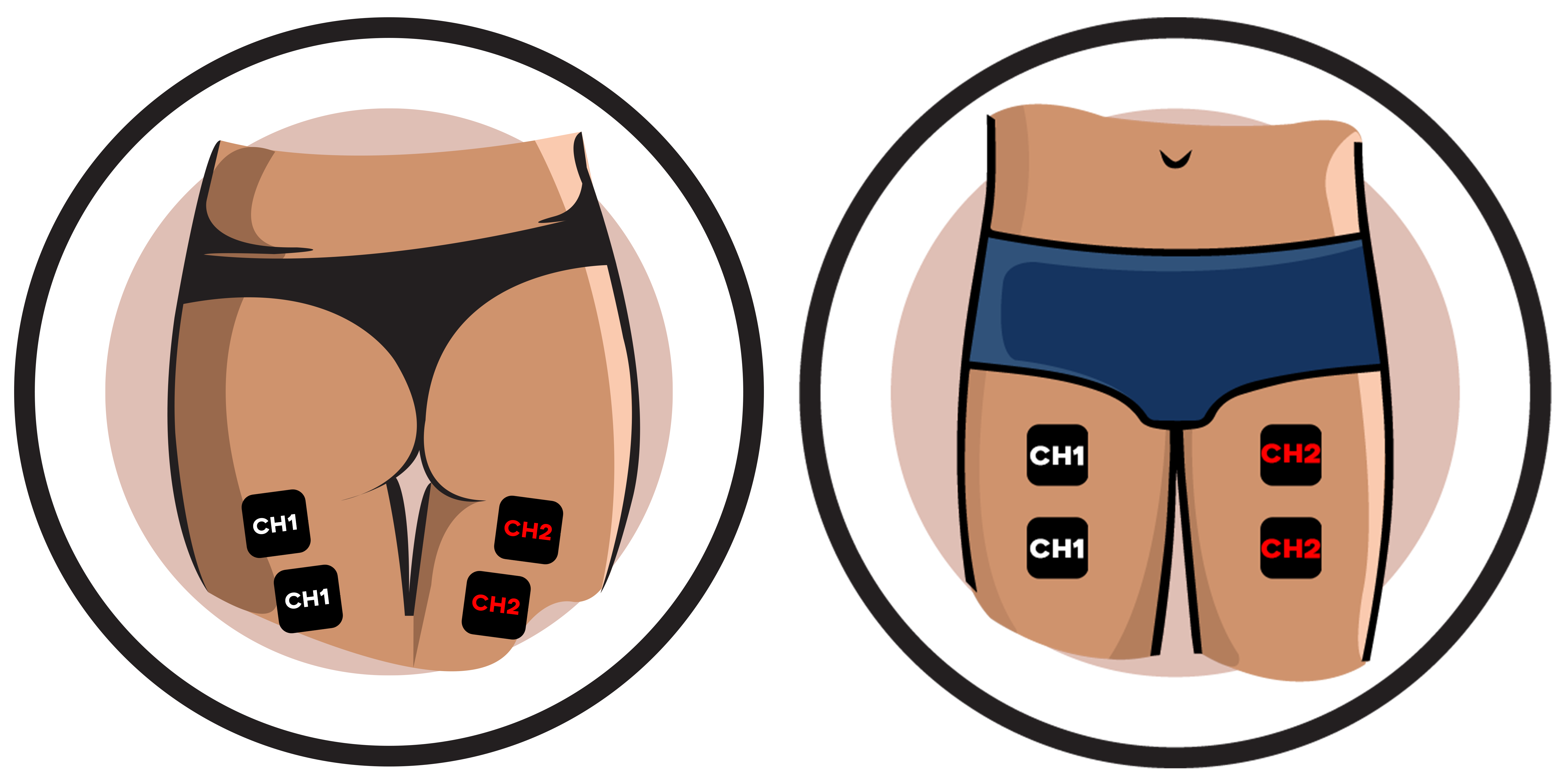 https://ireliev.com/wp-content/uploads/2016/12/Thighs-Electrode-Pad-Placements-4.png