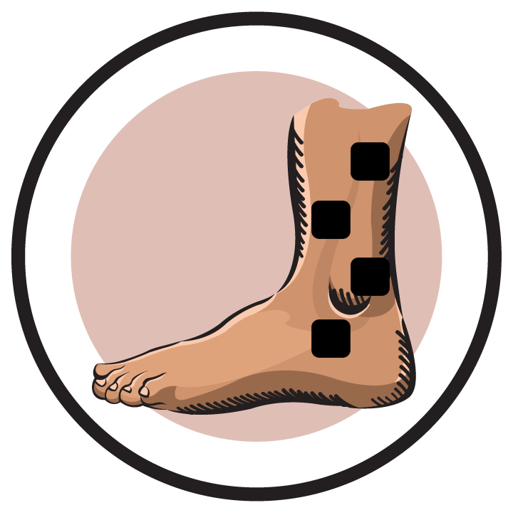https://ireliev.com/wp-content/uploads/2016/12/ankle-illustration-ligament-tear.png