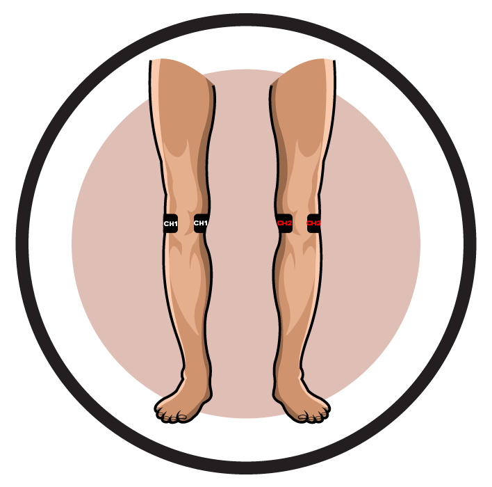 Knee Arthroscopy Post-Operative Pain Electrode Pad Placement