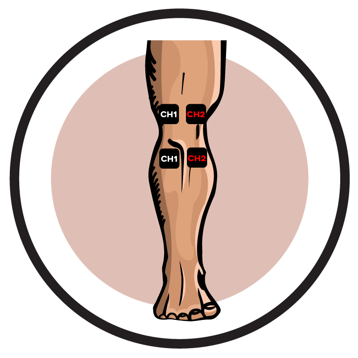 Knee Arthroscopy Post-Operative Pain Electrode Pad Placement