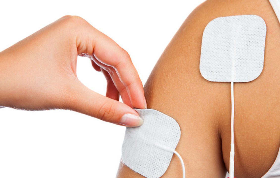 How to Place Electrodes for a Tens Unit: 11 Steps (with Pictures)